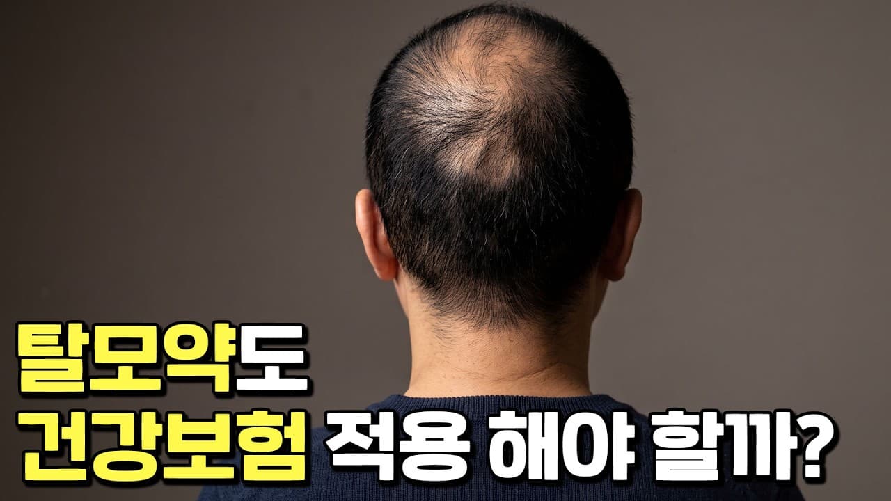 탈모약 건강보험 적용, 해야할까?